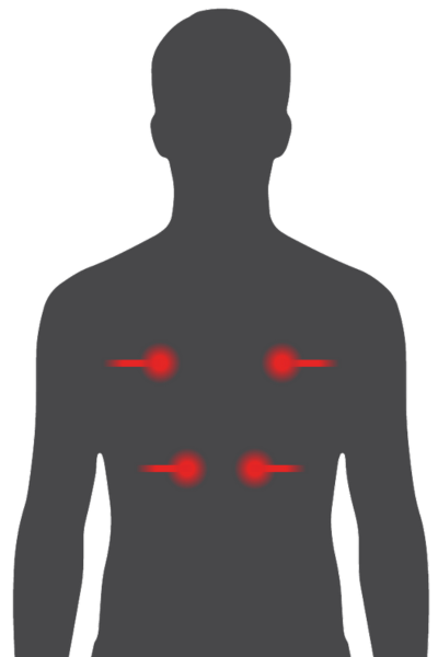 Recover XT Recover XT