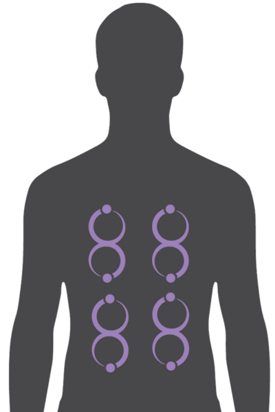 Oscillator STIL Serie Oscillator STIL Serie