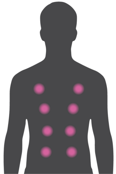 Alleviate STIL Serie Alleviate STIL Serie